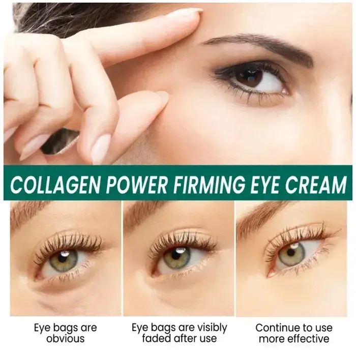 Crème pour les yeux, élimine les cernes