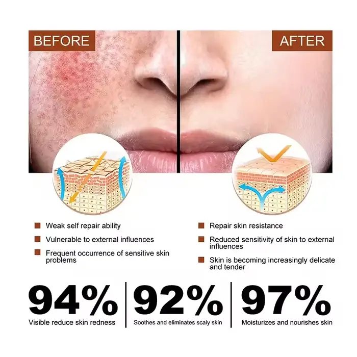Crème réparatrice des rougeurs du visage coréenne