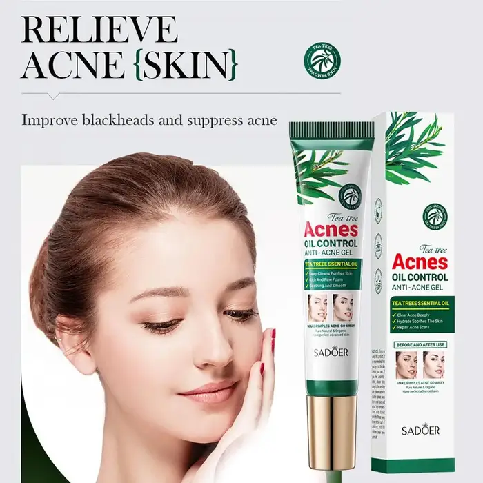 Crème anti-acné à l'arbre à thé SADOER