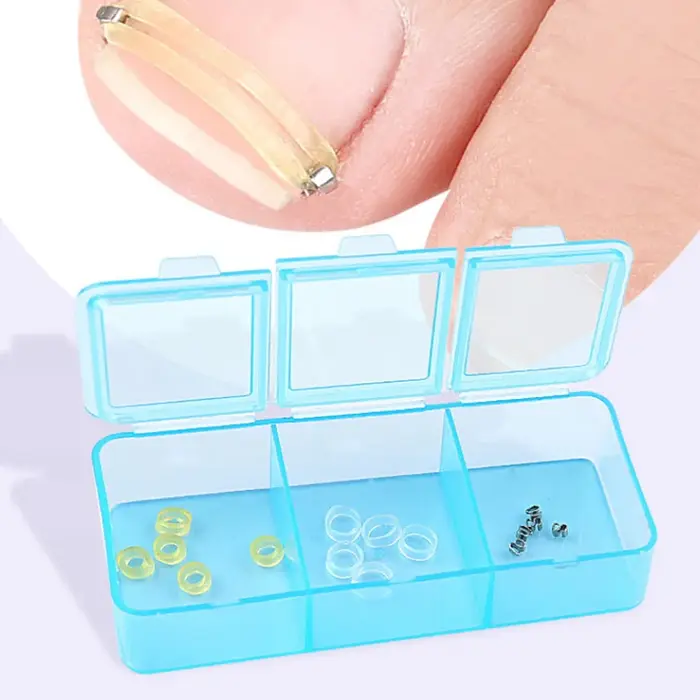 Correcteur d'ongles incarnés