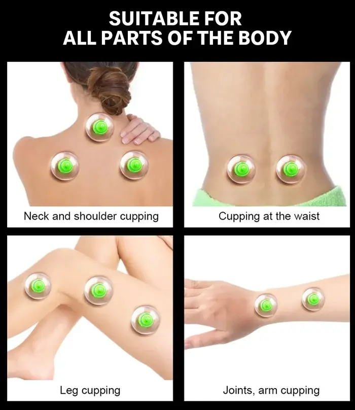 Kit de ventouses pour la réduction de la cellulite