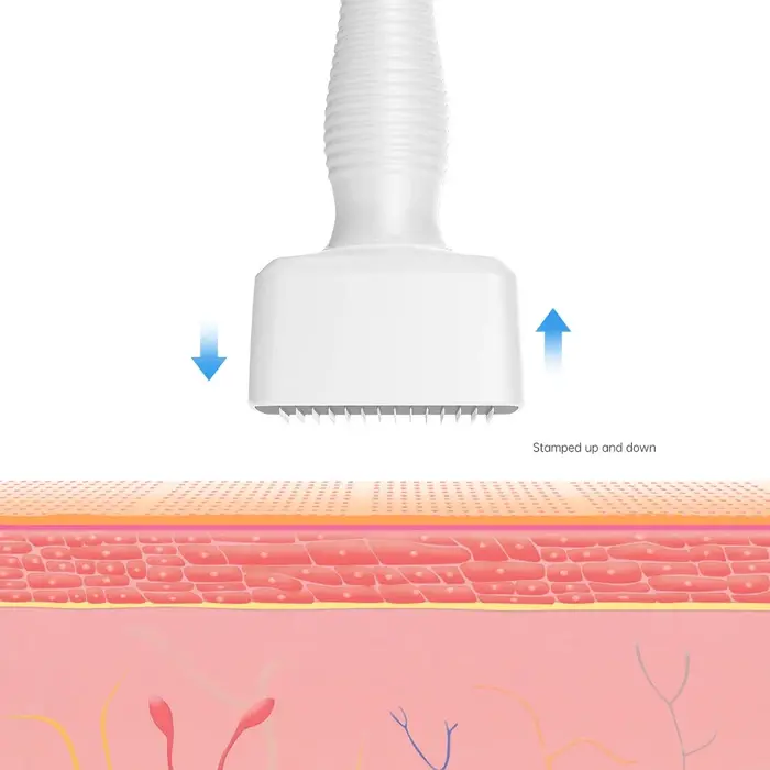 Tampon Derma blanc 140 broches