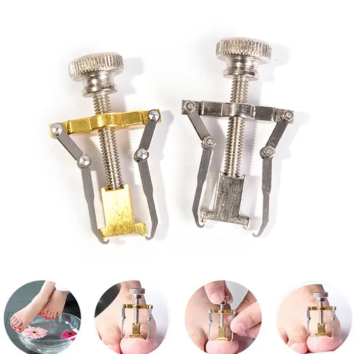 Correction professionnelle des ongles incarnés