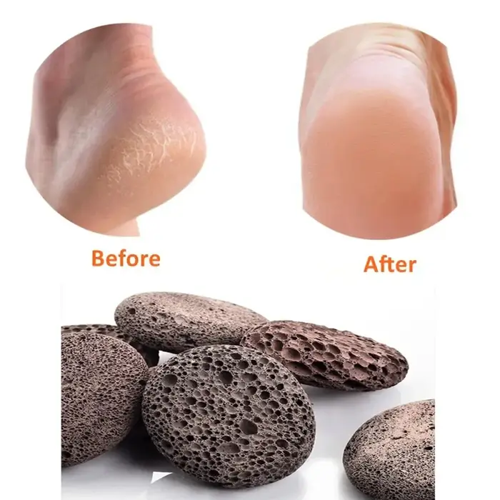 Pierre ponce naturelle pour pédicure, outil exfoliant pour les pieds, élimine les callosités et les 
