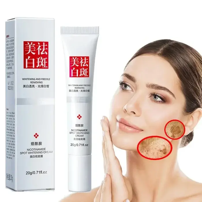 Crème pour le visage, estompe les taches de rousseur, taches foncées, Niacinamide, crème blanchissan