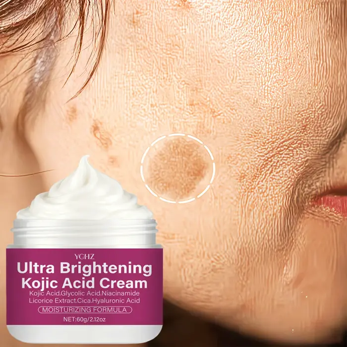 Crème éclaircissante à l'acide kojique contenant de la niacinamide