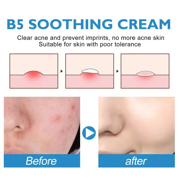 Crème Réparatrice B5 Hydratante Apaisante pour Peaux Sèches