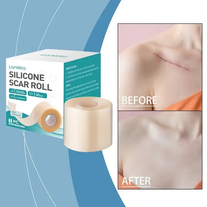 Rouleau hydrocolloïde de Patch de cicatrice de Silicone pour le soin des plaies pansements