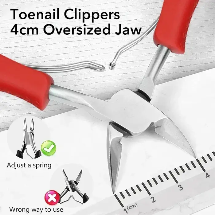 Kit professionnel de correction des ongles incarnés – Coupe-ongles de qualité podologique